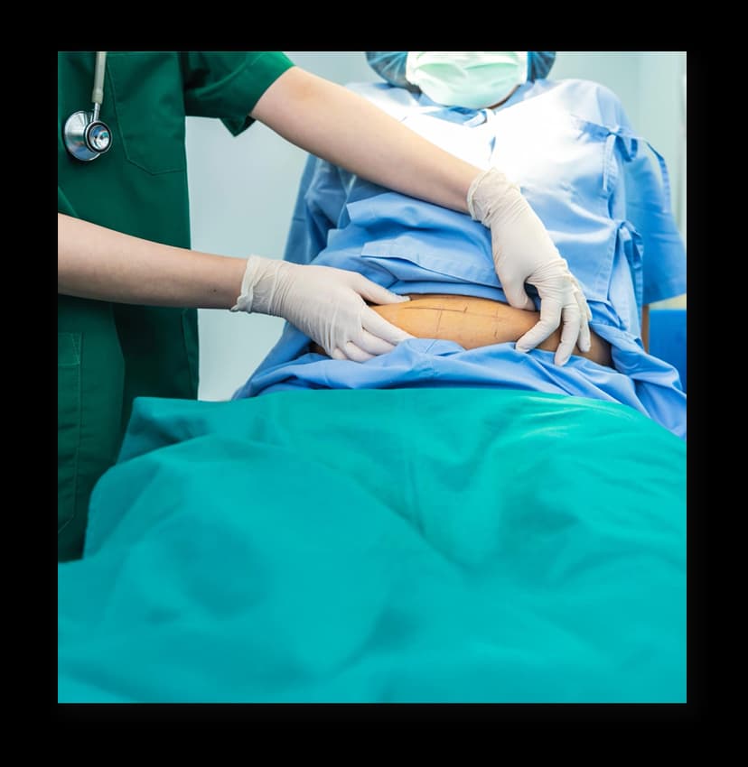 Stomach Ulcer Surgery